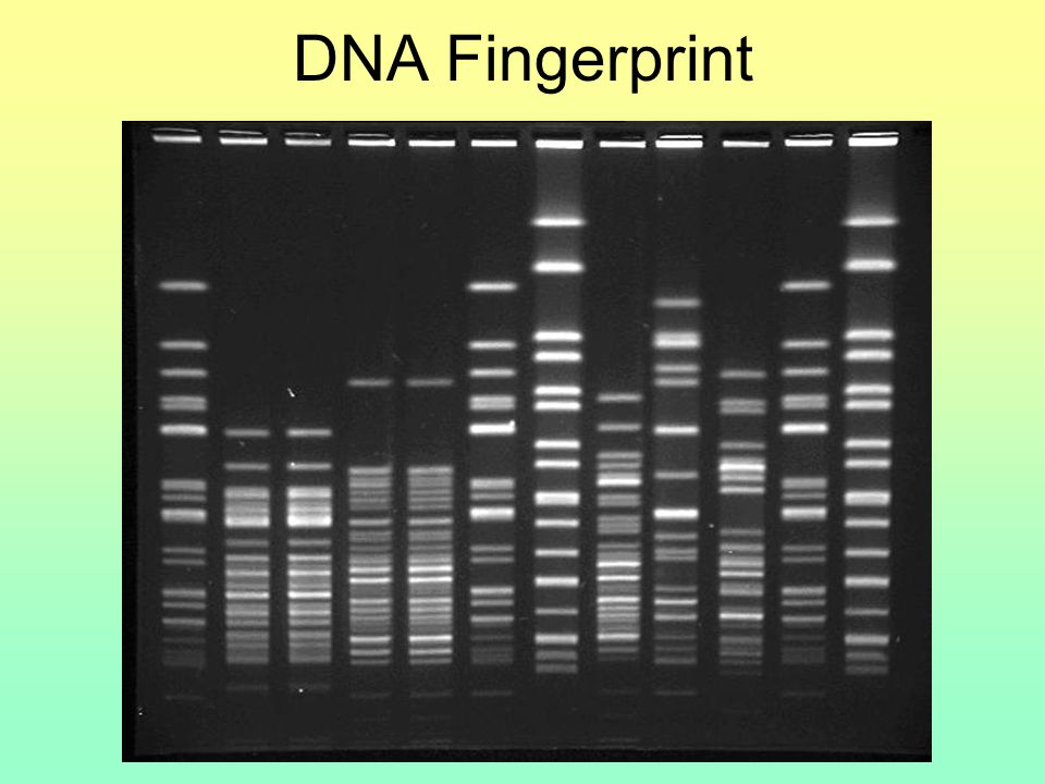 DNA Fingerprint