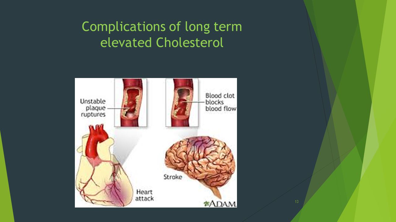 13 Complications of long term elevated Cholesterol