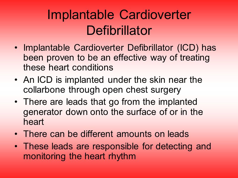 Implantable Cardioverter Defibrillator Implantable Cardioverter Defibrillator (ICD) has been proven to be an effective way of treating these heart conditions An ICD is implanted under the skin near the collarbone through open chest surgery There are leads that go from the implanted generator down onto the surface of or in the heart There can be different amounts on leads These leads are responsible for detecting and monitoring the heart rhythm