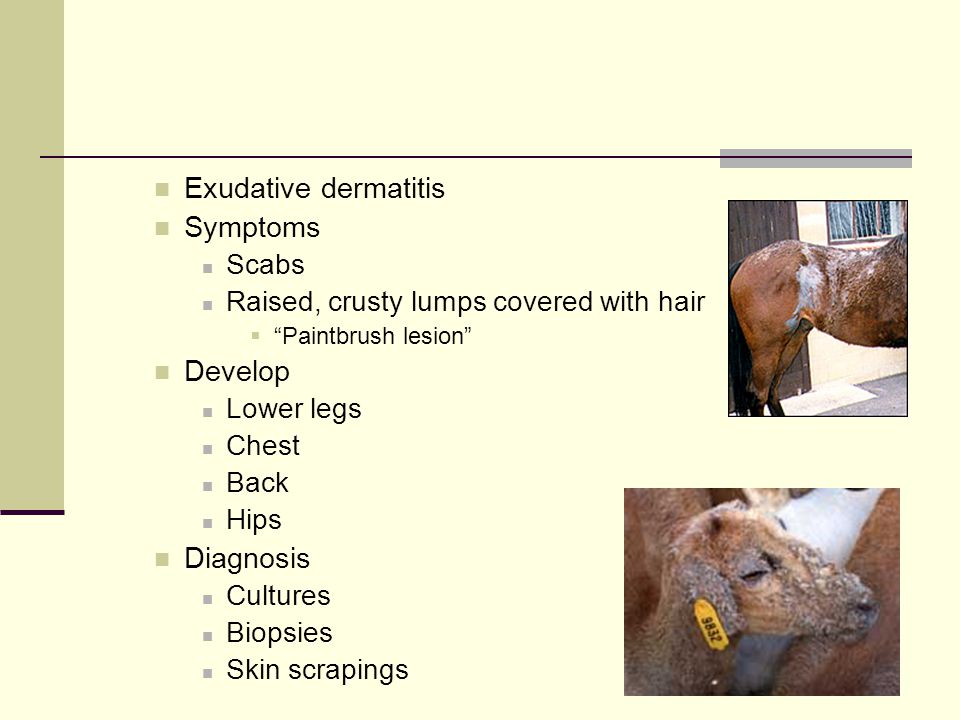 Exudative dermatitis Symptoms Scabs Raised, crusty lumps covered with hair  Paintbrush lesion Develop Lower legs Chest Back Hips Diagnosis Cultures Biopsies Skin scrapings