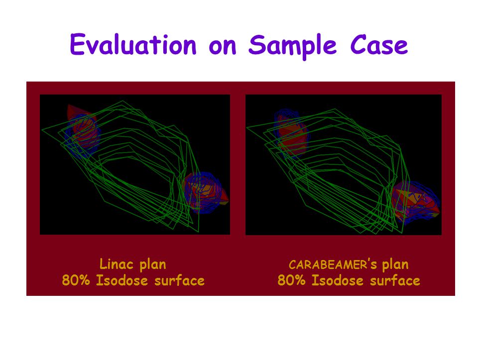 Evaluation on Sample Case Linac plan 80% Isodose surface CARABEAMER ’s plan 80% Isodose surface