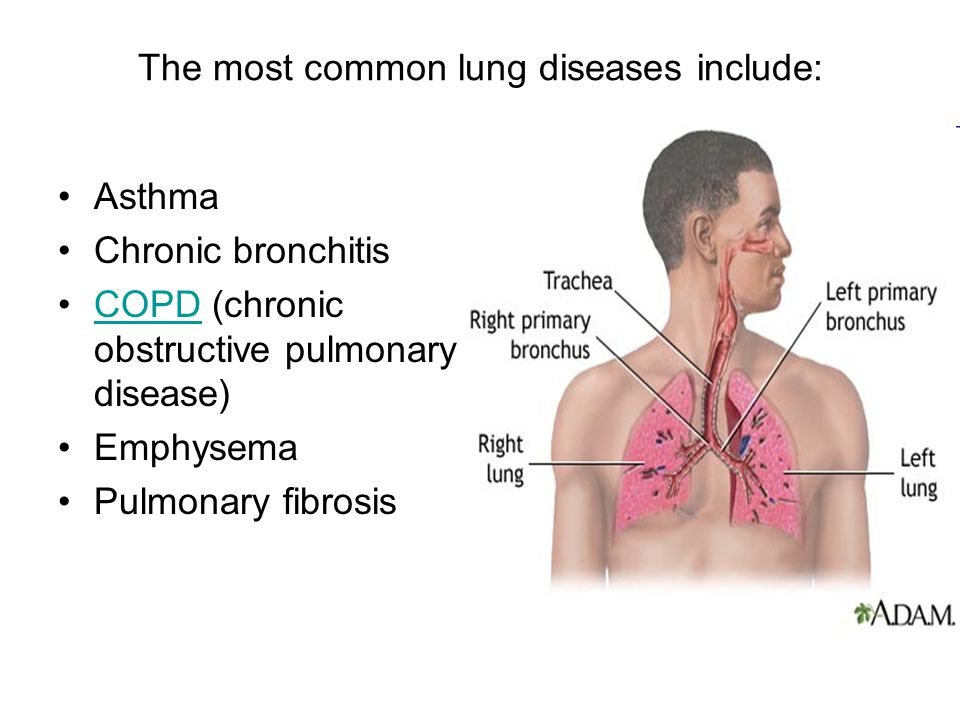 The most common lung diseases include: Asthma Chronic bronchitis COPD (chronic obstructive pulmonary disease)COPD Emphysema Pulmonary fibrosis