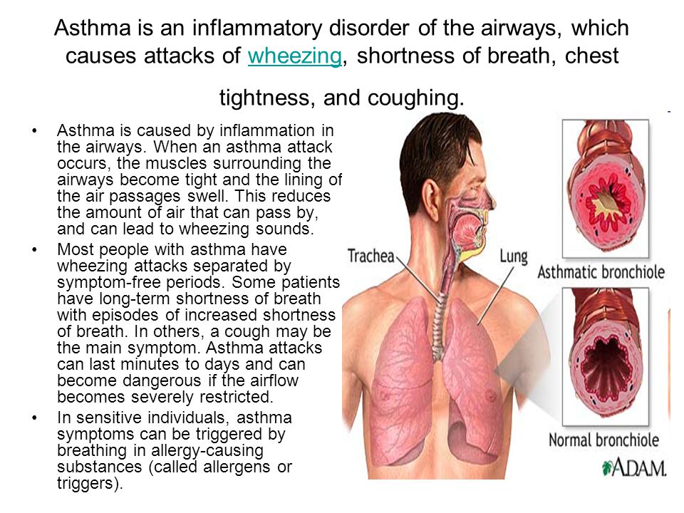 Asthma is an inflammatory disorder of the airways, which causes attacks of wheezing, shortness of breath, chest tightness, and coughing.wheezing Asthma is caused by inflammation in the airways.
