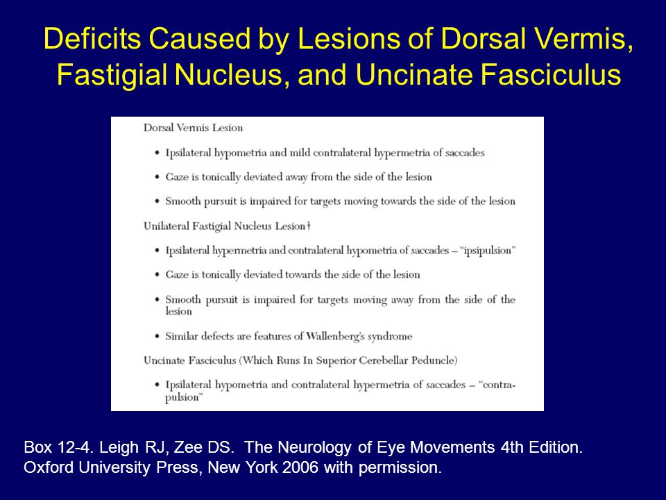 Deficits Caused by Lesions of Dorsal Vermis, Fastigial Nucleus, and Uncinate Fasciculus Box 12-4.