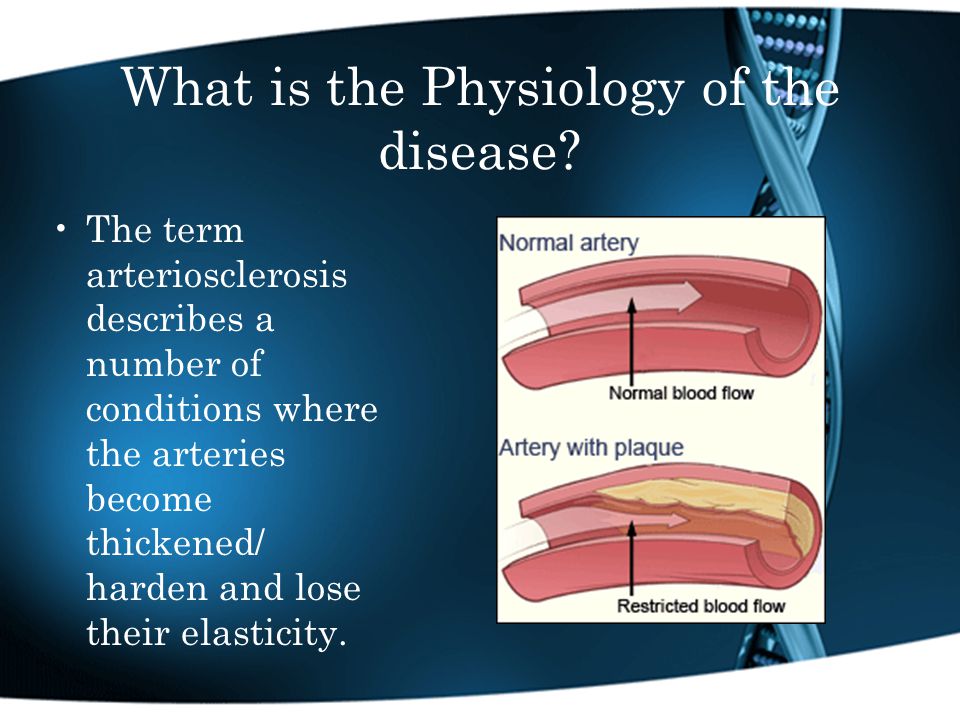 What is the Physiology of the disease.