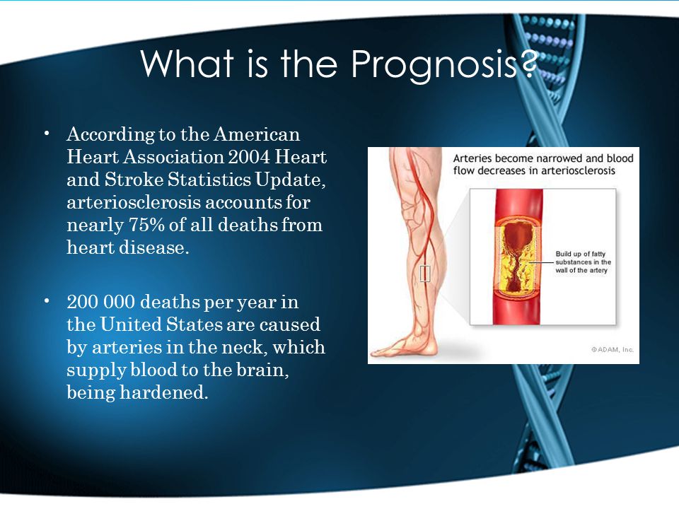 What is the Prognosis.