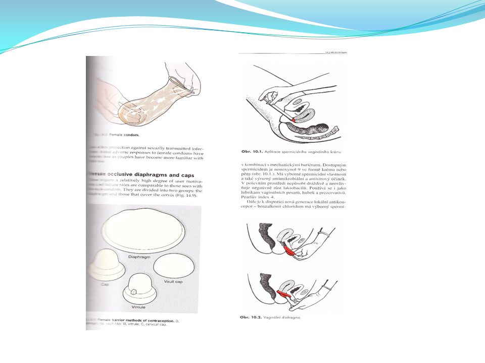 Progesterone Transdermal Patch