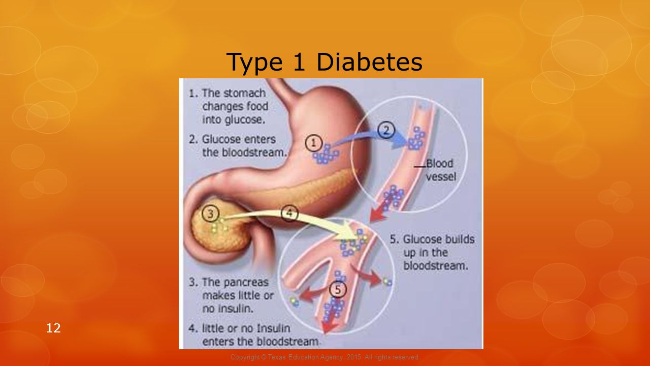 Type 1 Diabetes 12 Copyright © Texas Education Agency, All rights reserved.