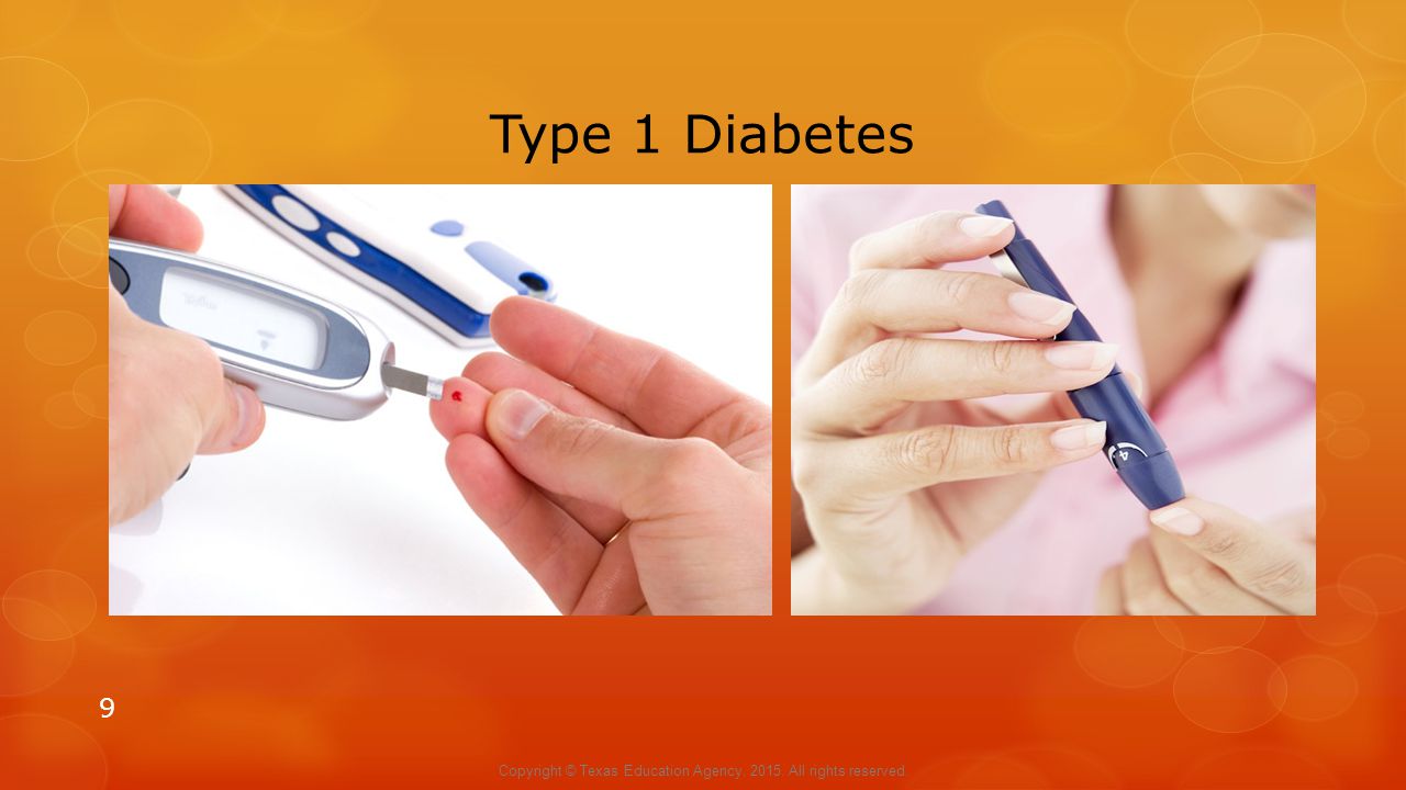 Type 1 Diabetes 9 Copyright © Texas Education Agency, All rights reserved.