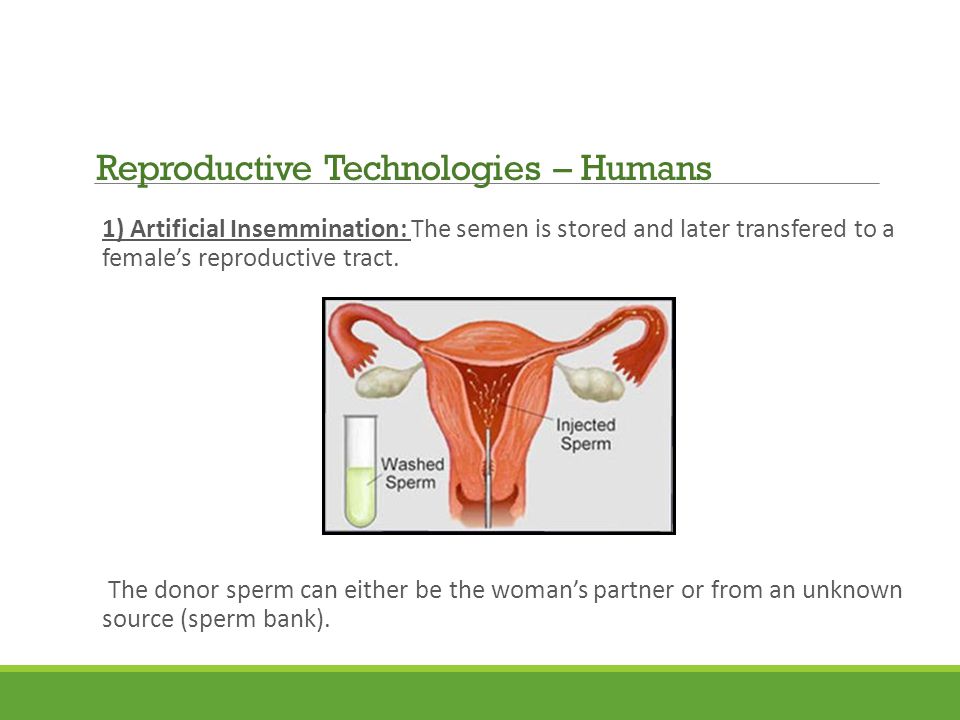 1) Artificial Insemmination: The semen is stored and later transfered to a female’s reproductive tract.