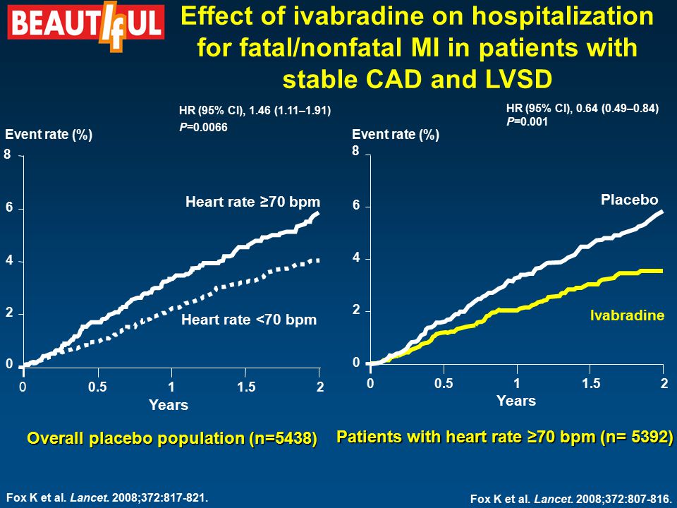 Patients with heart rate ≥70 bpm (n= 5392) Placebo Ivabradine HR (95% CI), 0.64 (0.49–0.84) P=0.001 Years Effect of ivabradine on hospitalization for fatal/nonfatal MI in patients with stable CAD and LVSD Overall placebo population (n=5438) Fox K et al.