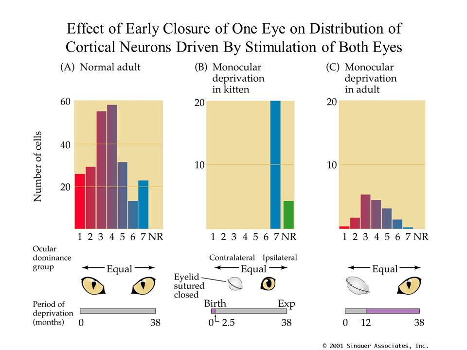 PN24040.JPG Effect of Early Closure of One Eye on Distribution of Cortical Neurons Driven By Stimulation of Both Eyes