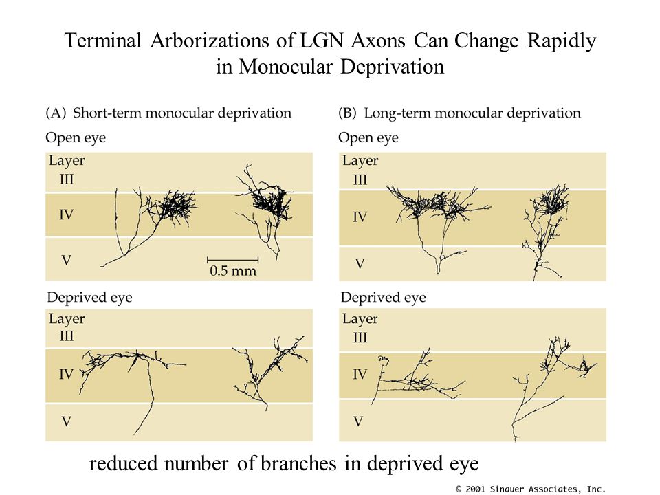 Terminal Arborizations of LGN Axons Can Change Rapidly in Monocular Deprivation reduced number of branches in deprived eye