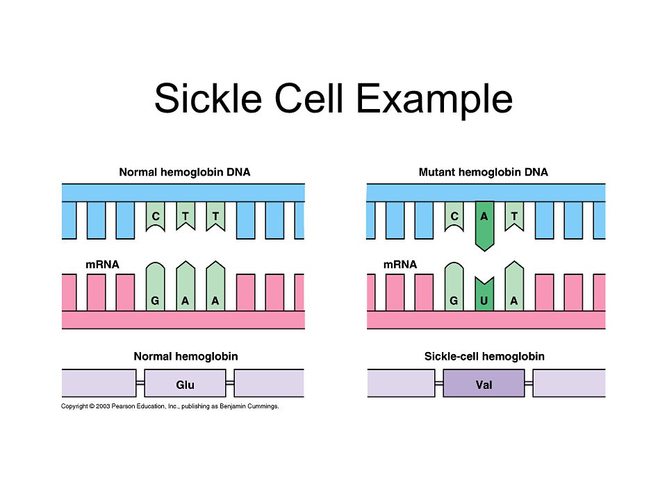Sickle Cell Example