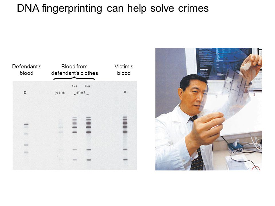 DNA fingerprinting can help solve crimes Defendant’s blood Blood from defendant’s clothes Victim’s blood