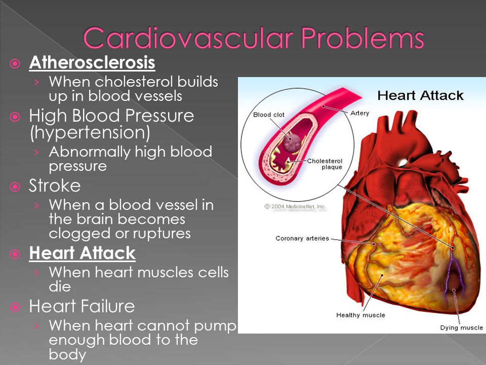 Atherosclerosis › When cholesterol builds up in blood vessels  High Blood Pressure (hypertension) › Abnormally high blood pressure  Stroke › When a blood vessel in the brain becomes clogged or ruptures  Heart Attack › When heart muscles cells die  Heart Failure › When heart cannot pump enough blood to the body