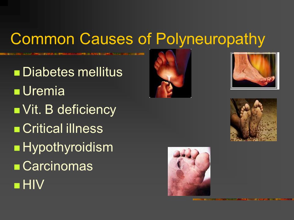 Critical illness polyneuropathy a review of the literature definition and pathophysiology