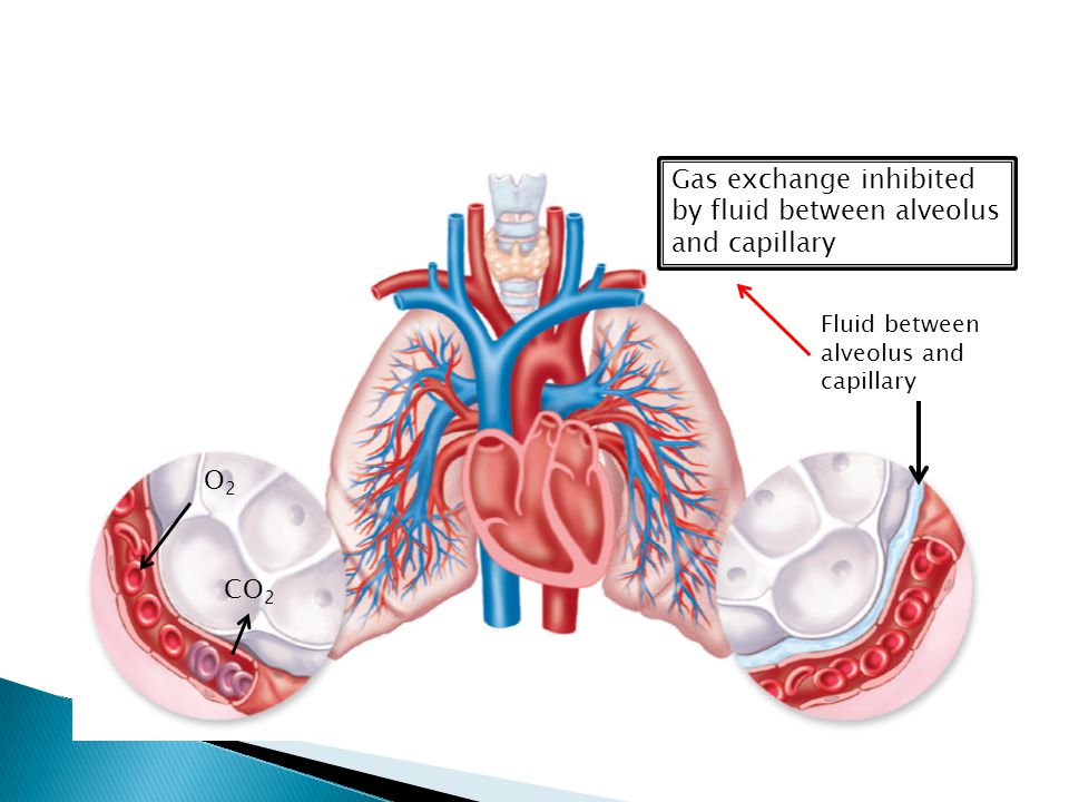 Fluid between alveolus and capillary CO 2 O2O2 Gas exchange inhibited by fluid between alveolus and capillary