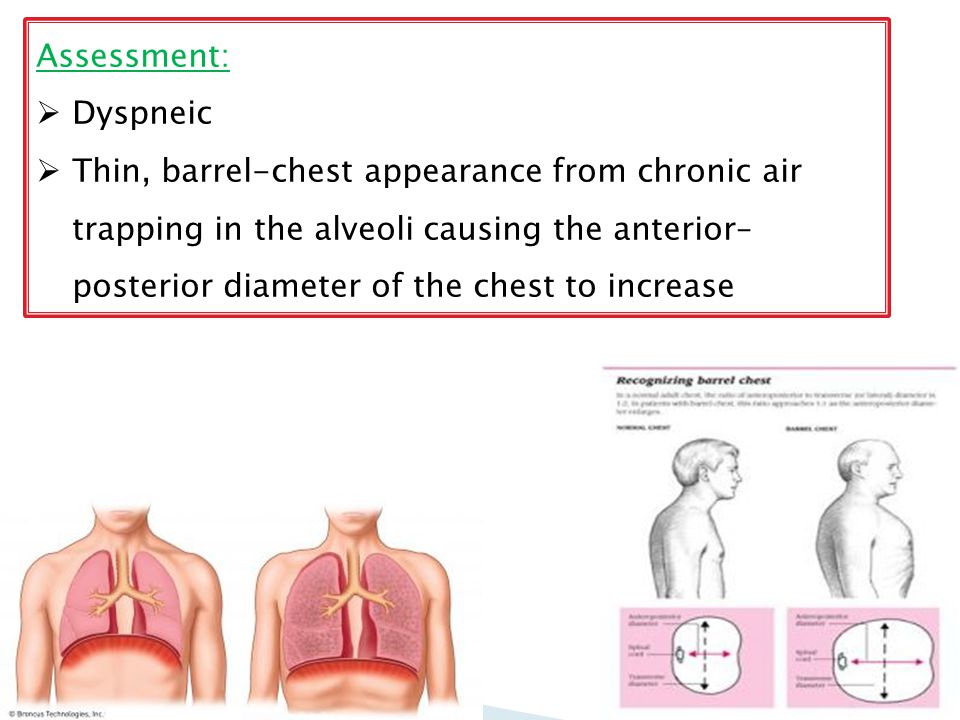 Assessment:  Dyspneic  Thin, barrel-chest appearance from chronic air trapping in the alveoli causing the anterior– posterior diameter of the chest to increase