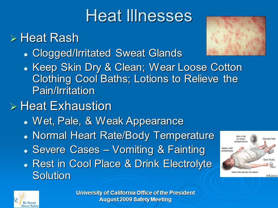 University of California Office of the President August 2009 Safety Meeting Heat Illnesses  Heat Rash Clogged/Irritated Sweat Glands Clogged/Irritated Sweat Glands Keep Skin Dry & Clean; Wear Loose Cotton Clothing Cool Baths; Lotions to Relieve the Pain/Irritation Keep Skin Dry & Clean; Wear Loose Cotton Clothing Cool Baths; Lotions to Relieve the Pain/Irritation  Heat Exhaustion Wet, Pale, & Weak Appearance Wet, Pale, & Weak Appearance Normal Heart Rate/Body Temperature Normal Heart Rate/Body Temperature Severe Cases – Vomiting & Fainting Severe Cases – Vomiting & Fainting Rest in Cool Place & Drink Electrolyte Solution Rest in Cool Place & Drink Electrolyte Solution