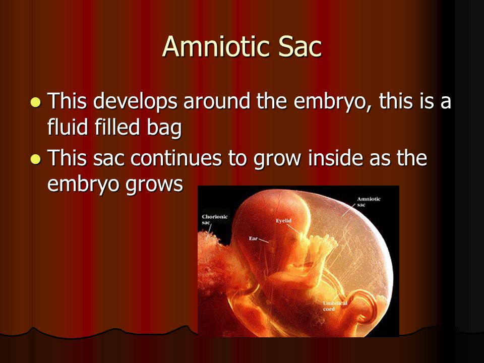 Amniotic Sac This develops around the embryo, this is a fluid filled bag This develops around the embryo, this is a fluid filled bag This sac continues to grow inside as the embryo grows This sac continues to grow inside as the embryo grows