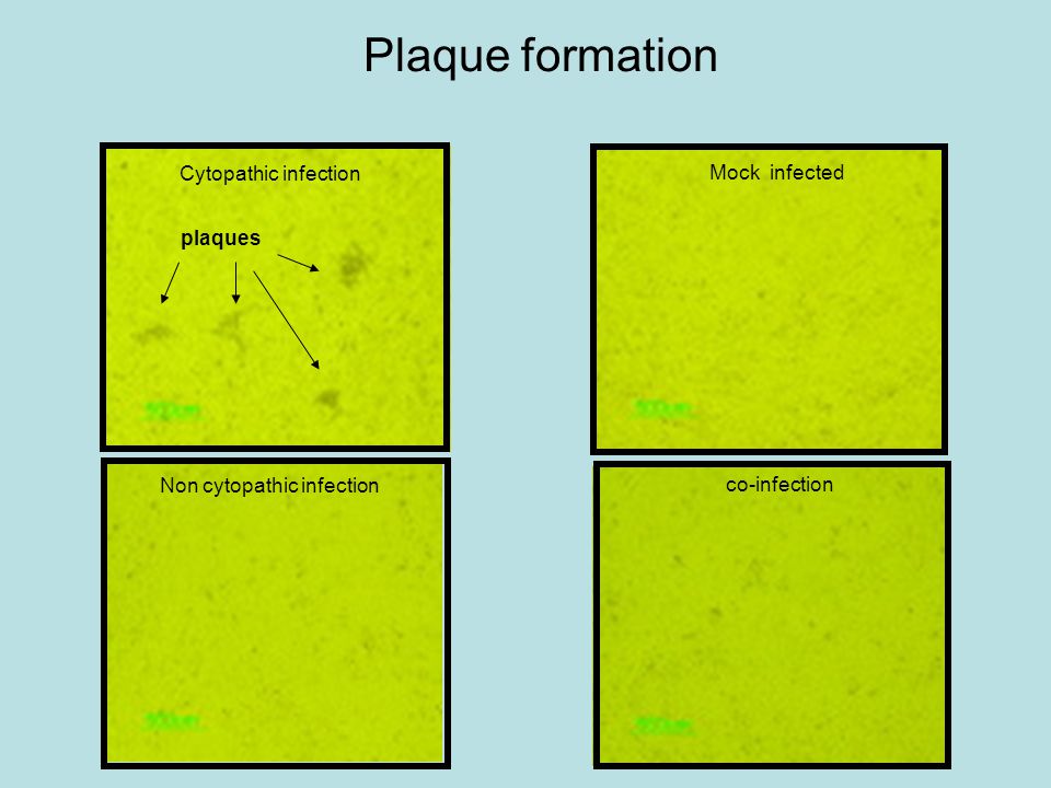 Plaque formation co-infection Non cytopathic infection Cytopathic infection Mock infected plaques