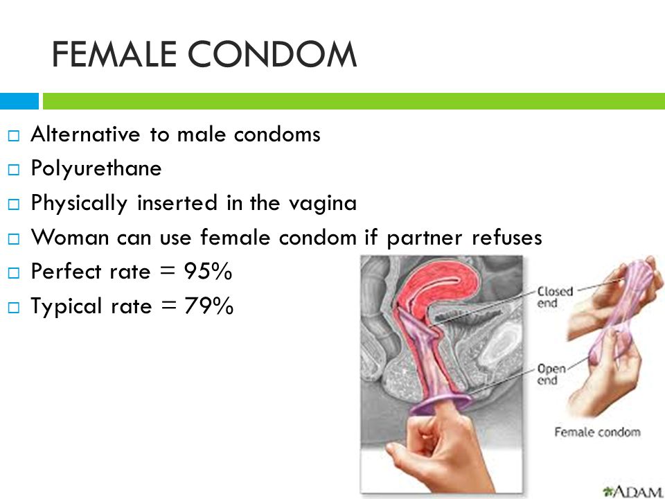FEMALE CONDOM  Alternative to male condoms  Polyurethane  Physically inserted in the vagina  Woman can use female condom if partner refuses  Perfect rate = 95%  Typical rate = 79%