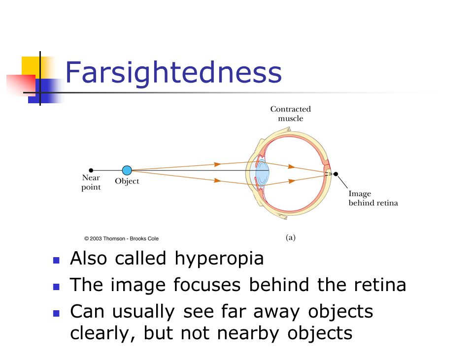 Farsightedness Also called hyperopia The image focuses behind the retina Can usually see far away objects clearly, but not nearby objects