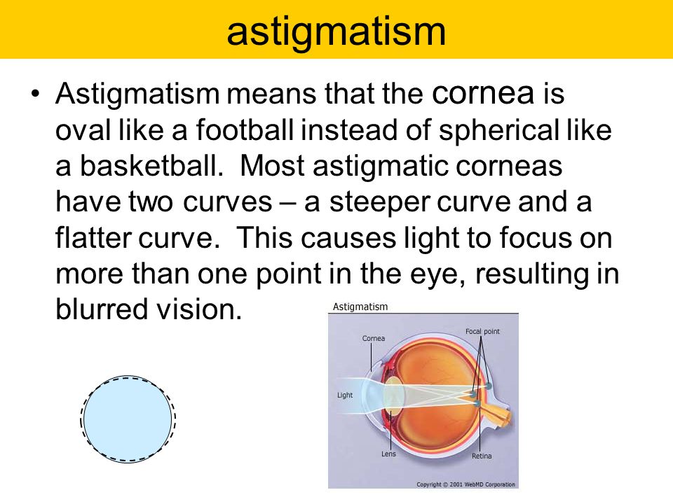 astigmatism Astigmatism means that the cornea is oval like a football instead of spherical like a basketball.
