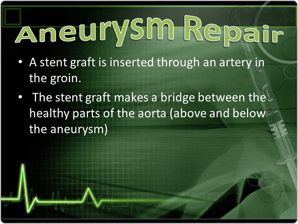 A stent graft is inserted through an artery in the groin.