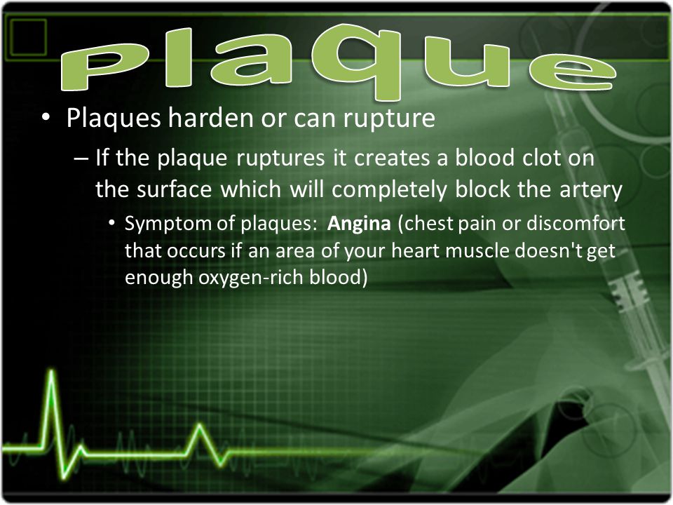 Plaques harden or can rupture – If the plaque ruptures it creates a blood clot on the surface which will completely block the artery Symptom of plaques: Angina (chest pain or discomfort that occurs if an area of your heart muscle doesn t get enough oxygen-rich blood)