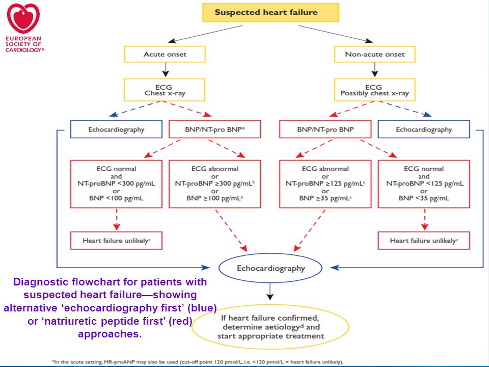 Diagnostic ﬂowchart for patients with suspected heart failure—showing alternative ‘echocardiography ﬁrst’ (blue) or ‘natriuretic peptide ﬁrst’ (red) approaches.