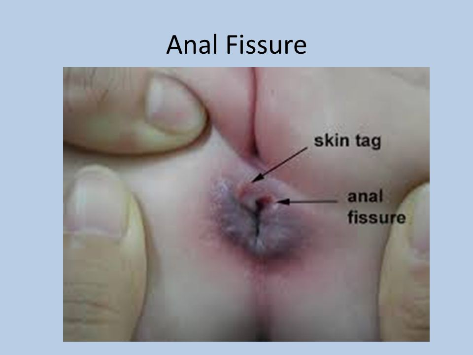 Odd anus sensation Beach slave femdom