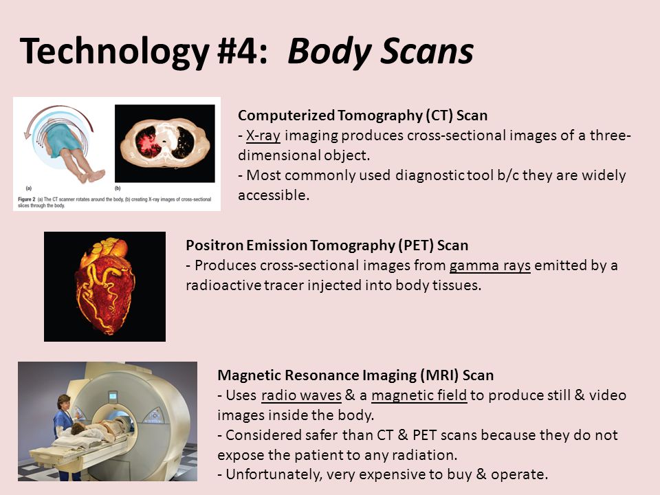 Technology #4: Body Scans Computerized Tomography (CT) Scan - X-ray imaging produces cross-sectional images of a three- dimensional object.