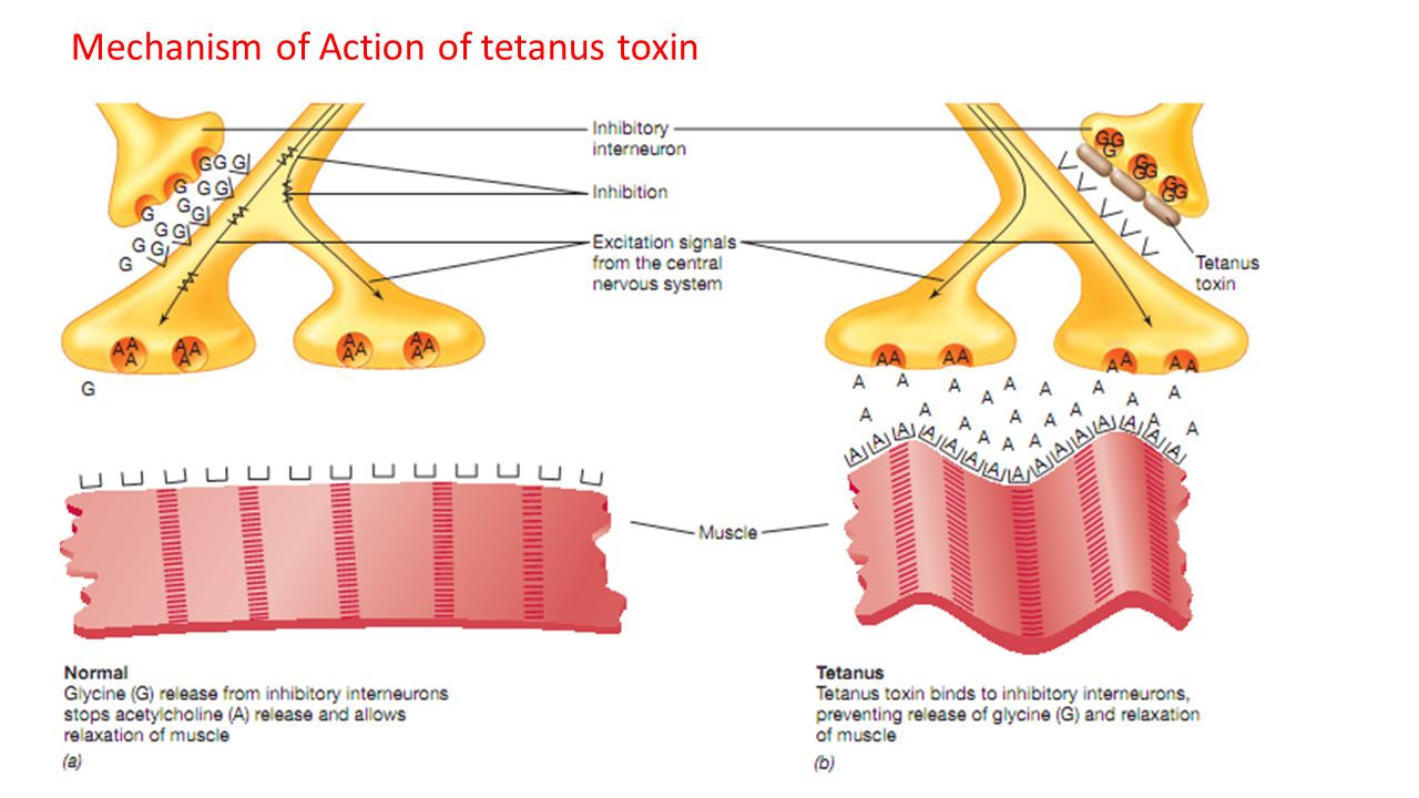 tetanus toxin