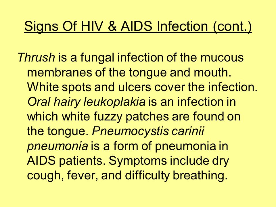 Signs Of HIV & AIDS Infection (cont.) Thrush is a fungal infection of the mucous membranes of the tongue and mouth.
