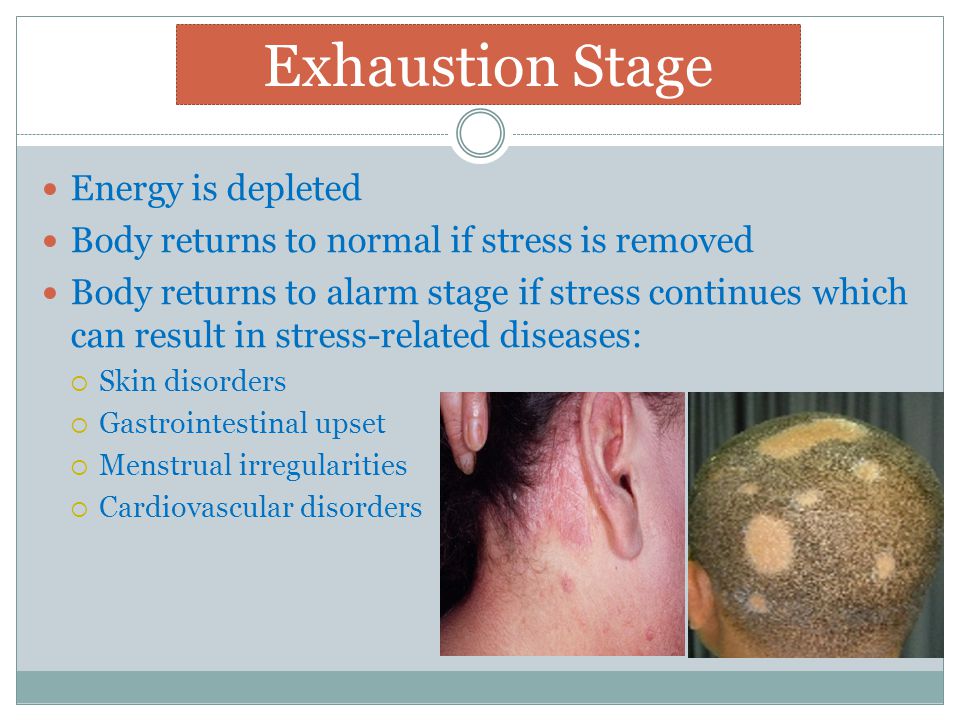 Exhaustion Stage Energy is depleted Body returns to normal if stress is removed Body returns to alarm stage if stress continues which can result in stress-related diseases:  Skin disorders  Gastrointestinal upset  Menstrual irregularities  Cardiovascular disorders