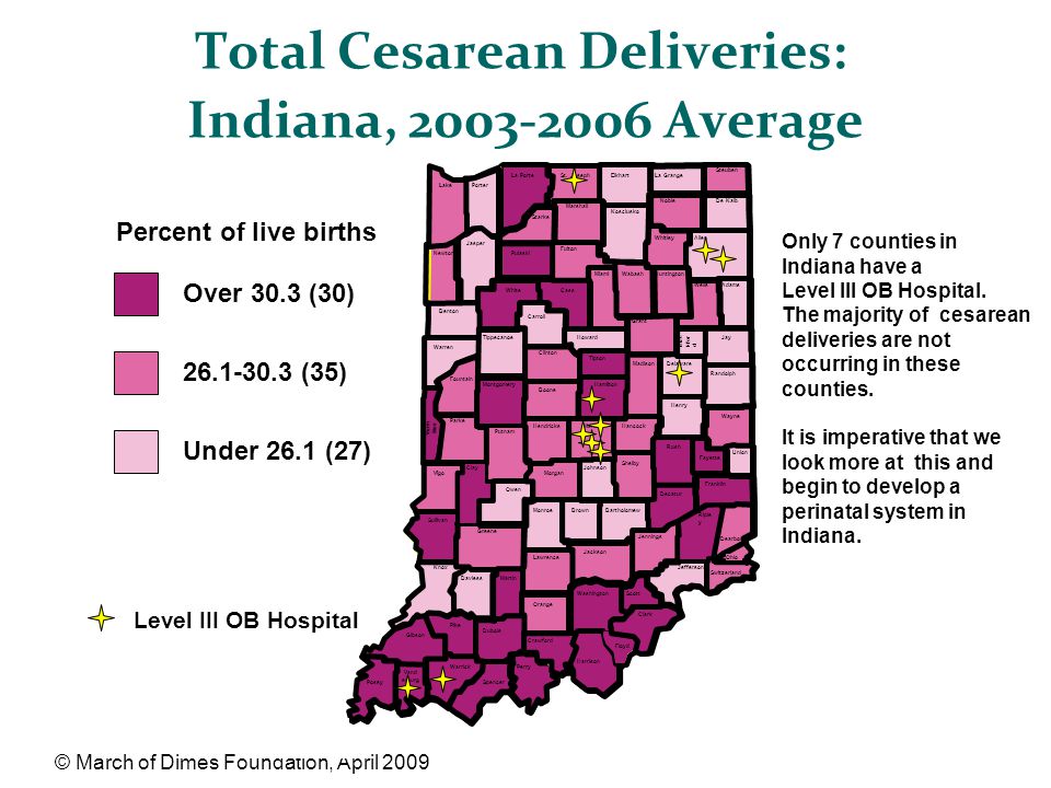 Total Cesarean Deliveries: Indiana, Average © March of Dimes Foundation, April 2009 Over 30.3 (30) (35) Under 26.1 (27) Percent of live births Level III OB Hospital Only 7 counties in Indiana have a Level III OB Hospital.