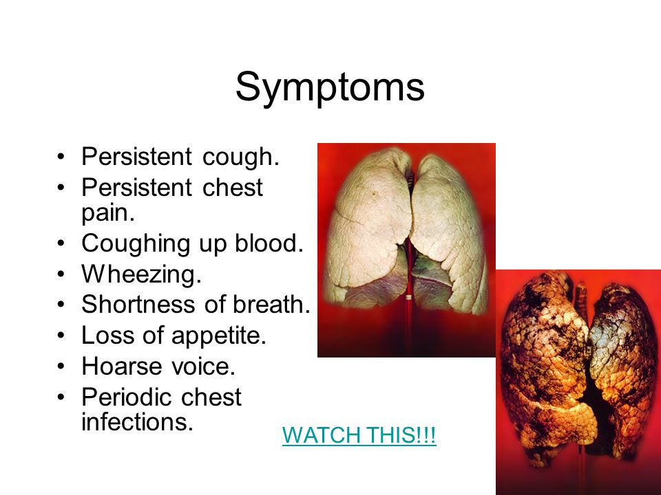 Symptoms Persistent cough. Persistent chest pain.
