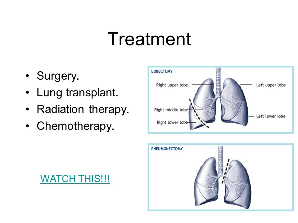 Treatment Surgery. Lung transplant. Radiation therapy. Chemotherapy. WATCH THIS!!!