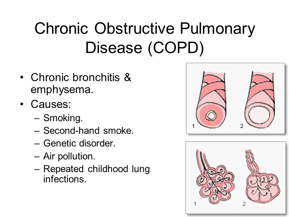 Chronic Obstructive Pulmonary Disease (COPD) Chronic bronchitis & emphysema.