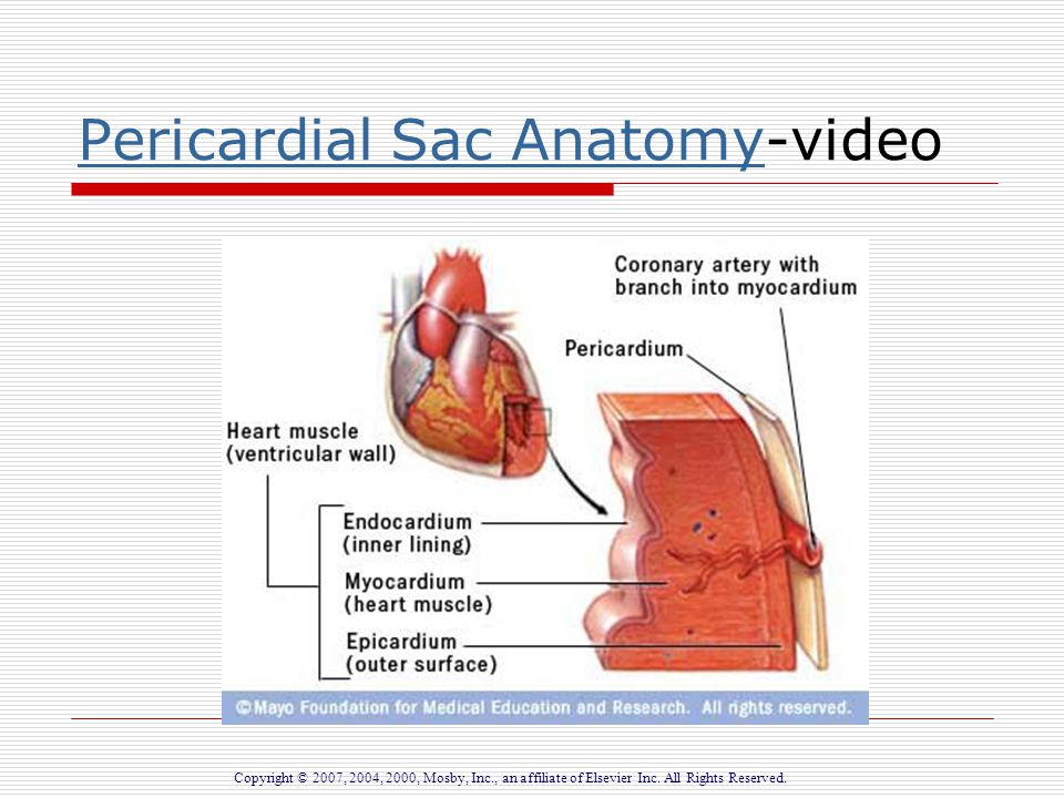 pericardial sac