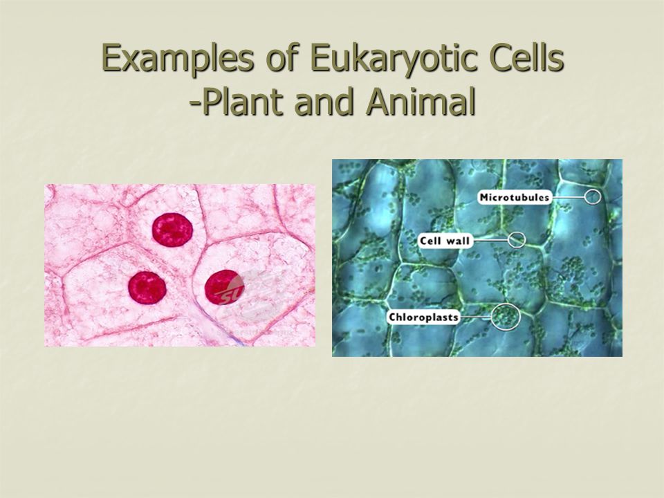 Examples of Eukaryotic Cells -Plant and Animal