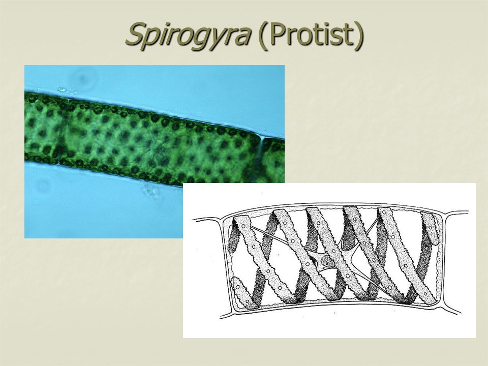 Spirogyra (Protist)