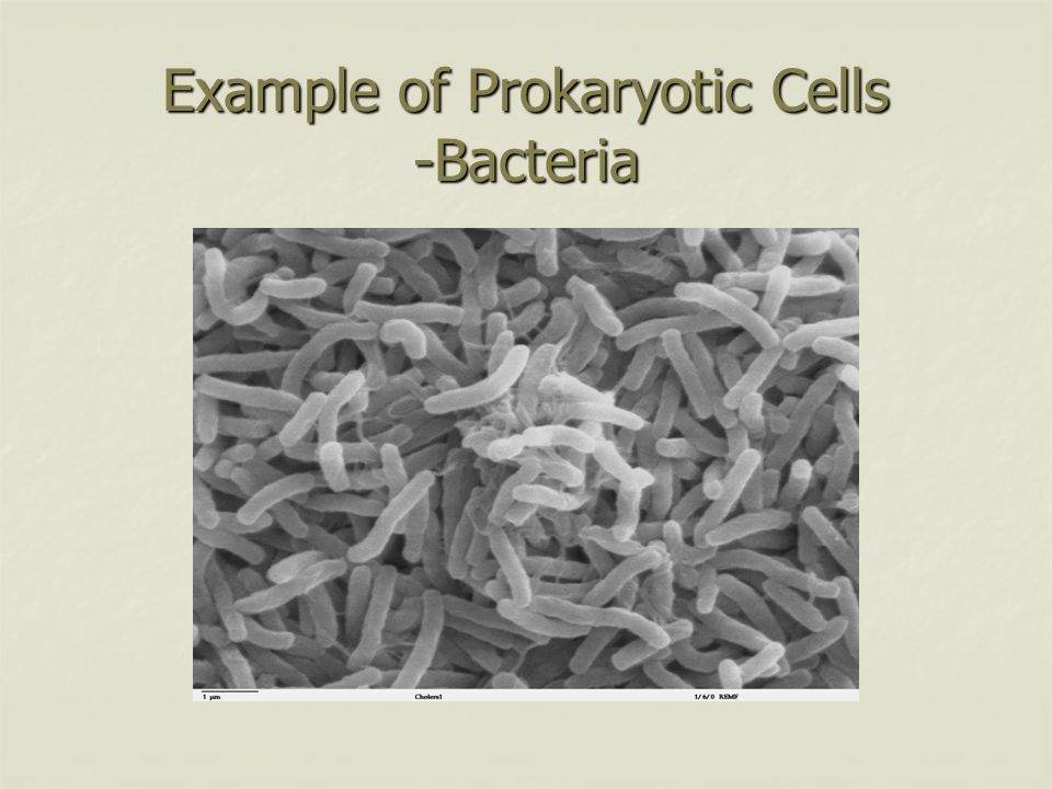 Example of Prokaryotic Cells -Bacteria