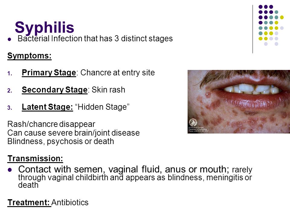 Bacterial vaginosis on the anus Big tit amatuer casting call video