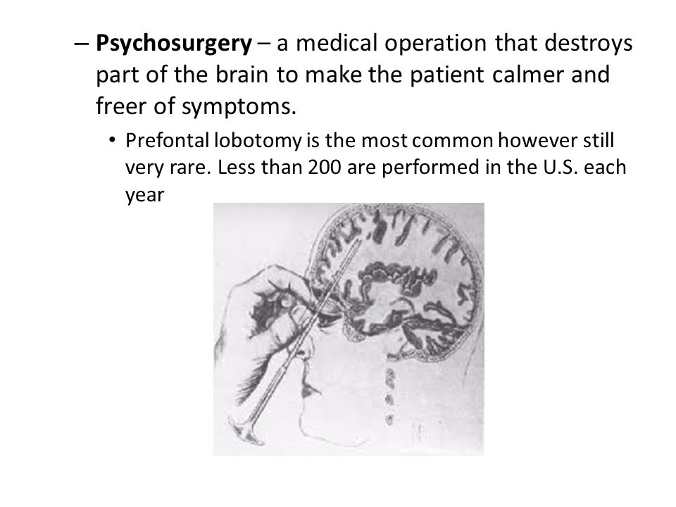– Psychosurgery – a medical operation that destroys part of the brain to make the patient calmer and freer of symptoms.