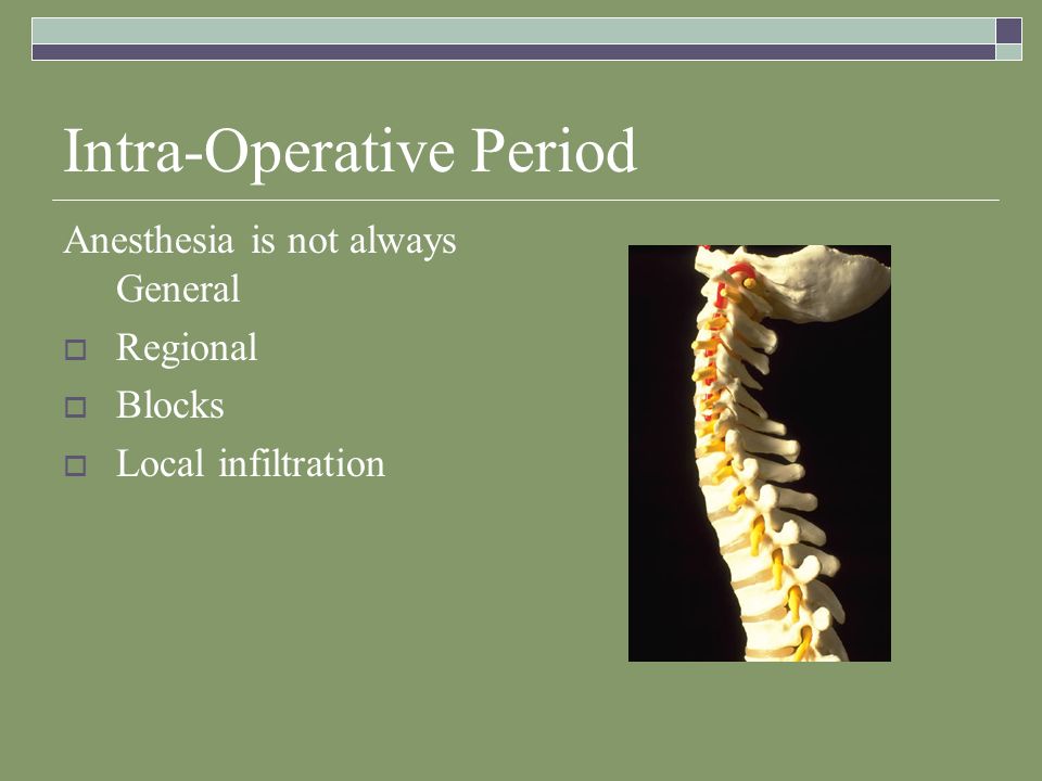 Intra-Operative Period Anesthesia is not always General  Regional  Blocks  Local infiltration