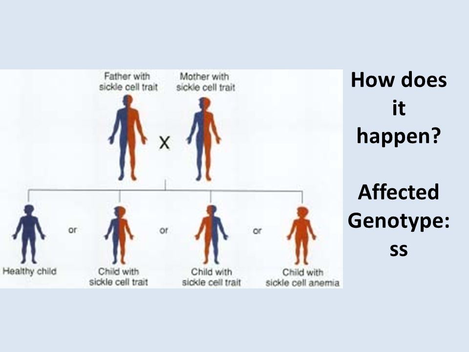 How does it happen Affected Genotype: ss
