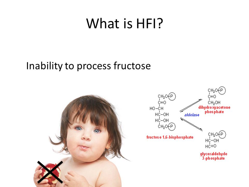 hereditary fructose intolerance